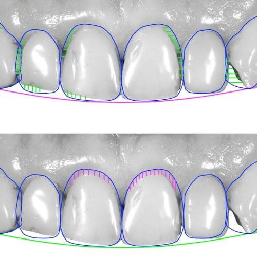 Digital-Smile-Design